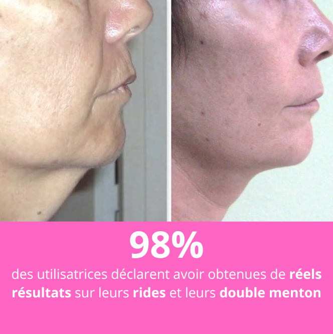 Liftya Pro®️ : Lifting & Raffermissement Visage et Cou avec lumière photonique